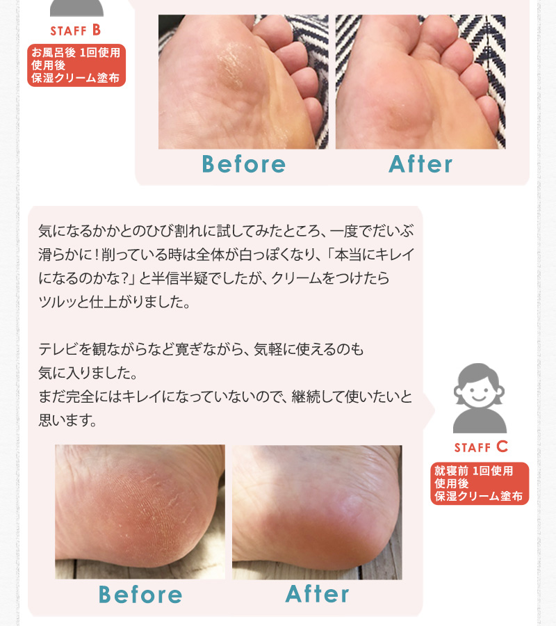 Tuyako Shiny Foot かかとが輝くシャープナー つやこ アンジェ Web Shop 本店
