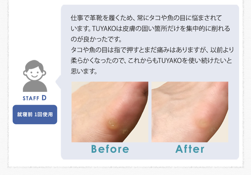 Tuyako Shiny Foot かかとが輝くシャープナー つやこ アンジェ Web Shop 本店